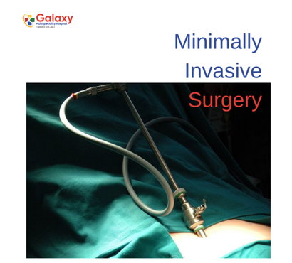 Minimally-Invasive-Surgery